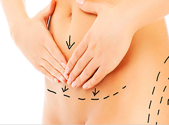 Mesoterapia em Curitiba